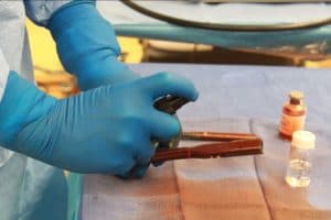 Implantes ortopédicos